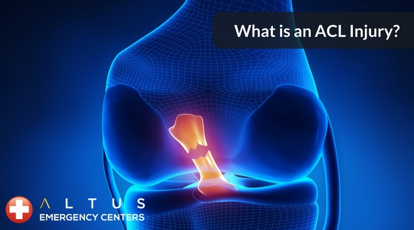 ACL-Injury-What-is-it-Altus-ER-Centers-Texas