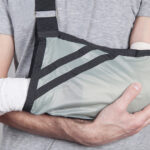 A man with an arm in a sling holds a cast, indicating a hand bone fracture.