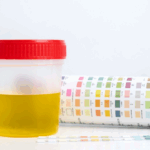 Urine sample container with red cap placed beside a color chart and test strips used for urine drug test analysis.